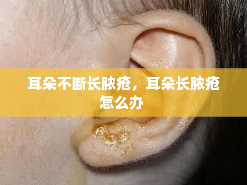耳朵不断长脓疮,耳朵长脓疮怎么办