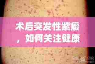 术后突发性紫癜，如何关注健康，预防意外风险？