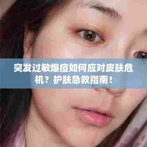 突发过敏爆痘如何应对皮肤危机？护肤急救指南！